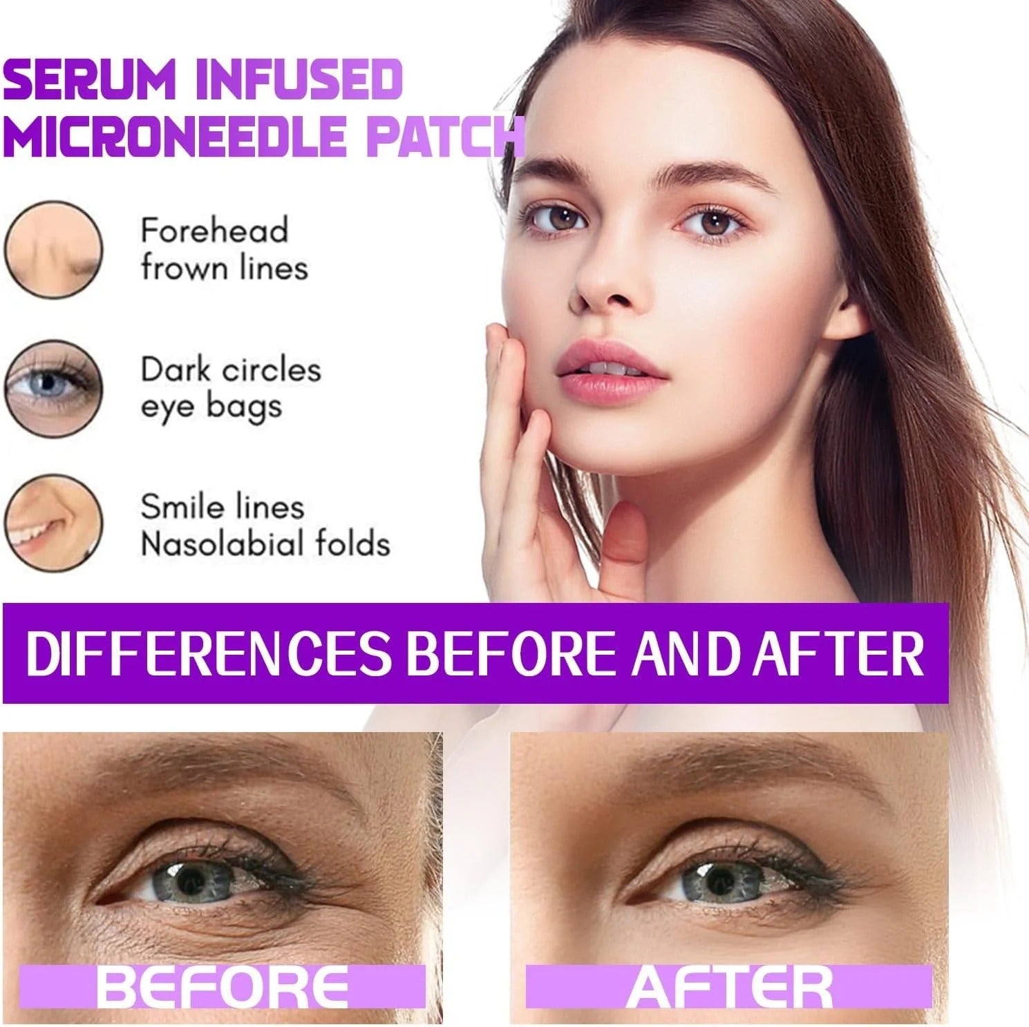 Microneedle Eye Patches for Bags & Dark Circles